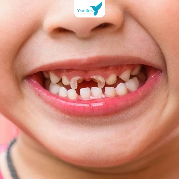 trẻ em khám răng tại nha khoa uy tín