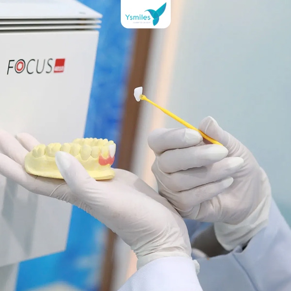 Công nghệ hiện đại có ảnh hưởng như thế nào đến giá bọc răng sứ thẩm mỹ