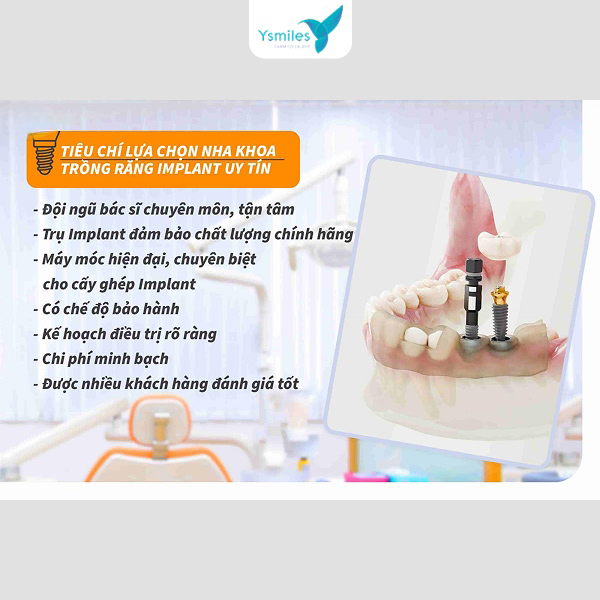 Trồng răng Implant tại Ysmile giải pháp khôi phục nụ cười hoàn hảo, ăn nhai chắc chắn như răng thật