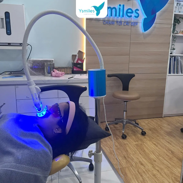 Tẩy trắng răng tại Ysmiles uy tín, không gây ê buốt hay tổn thương men