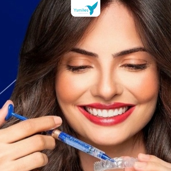 Tẩy trắng răng giúp cải thiện tình trạng răng ố vàng và xỉn màu hiệu quả