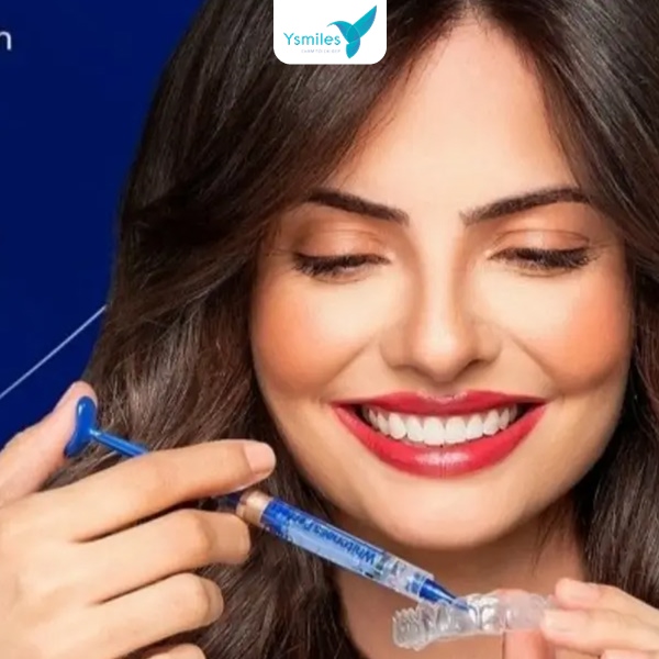 Tẩy trắng răng là kỹ thuật nha khoa giúp cải thiện màu sắc và độ sáng của răng