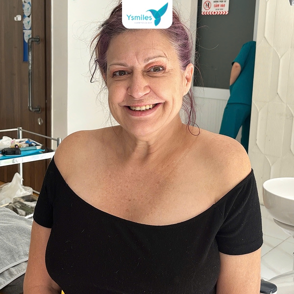 Chọn nơi trám răng uy tín để tránh bị ê buốt