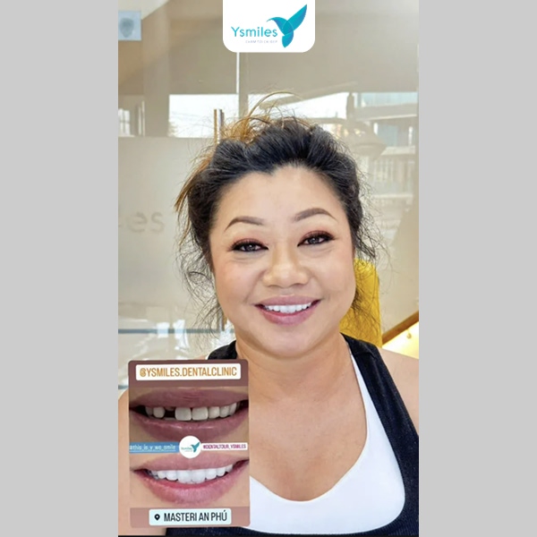Cân nhắc và lựa chọn nha khoa bọc răng sứ thẩm mỹ uy tín với đội ngũ y bác sĩ tay nghề cao