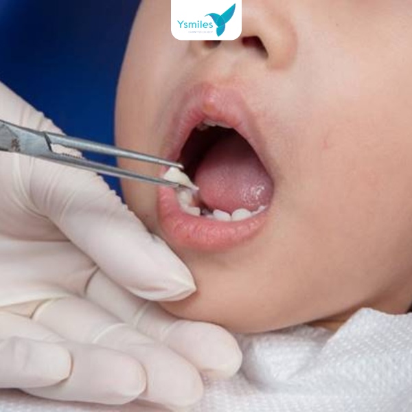 Ysmiles nha khoa trẻ em uy tín hàng đầu tại TP.HCM