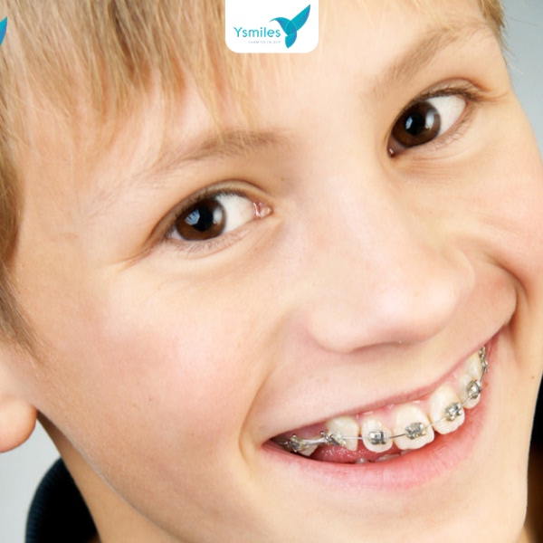 Ưu tiên chọn nha khoa trẻ em với đội ngũ y bác sĩ tay nghề cao