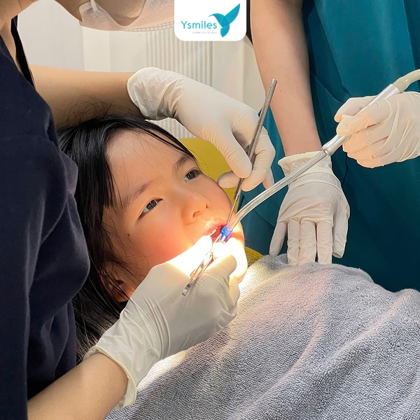 Thời điểm thích hợp để nhổ răng sữa cho bé là khi răng có dấu hiệu lung lay