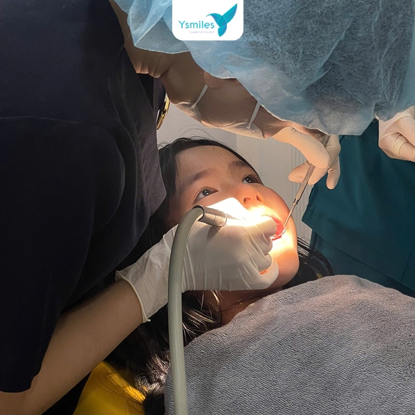 Chỉ nên nhổ răng sữa cho con tại nhà khi răng đã quá lung lay