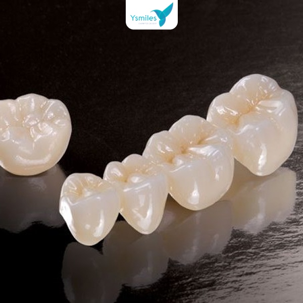 Răng sứ thẩm mỹ cao cấp, mang lại nụ cười tự tin và rạng rỡ