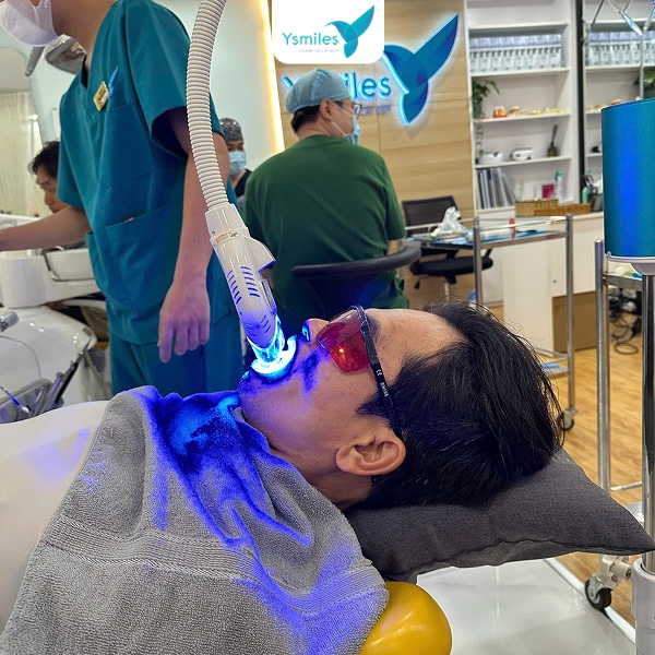 Hình ảnh điều trị răng không đều màu tại nha sĩ